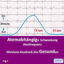 Warum Es Normal Ist Dass Die Herzfrequenz Schwankt Cardiopraxis