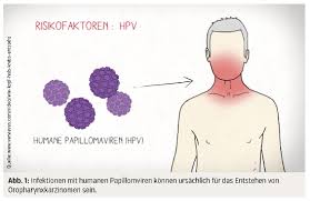 Die Rolle Von Hpv In Der Kopf Hals Onkologie Medmedia