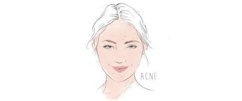 May 06, 2017 · eggs whites should be used with red spots on the face only, not acne. What Are Those Tiny Bumps On Your Face