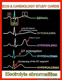 Keep Calm Nurse On Nursing Mnemonics Cardiology Study Cardiac Nursing
