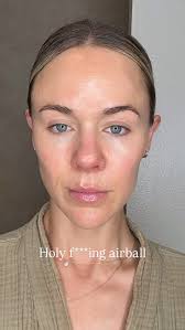 Fail….I look older 💀 Botox brow droop hit me hard! My muscles were always  so sensitive to Botox that I 8/10 times I had a brow droop, maybe that was  the universes way of telling me to avoid the black ...