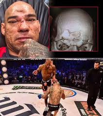 🩸 Michael 'Venom' Page inflicts damage to his opponents. How many wins and  losses MVP will have in the UFC?Thoughts? 🤔