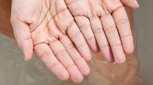 Endlich Verstehen Darum Schrumpeln Unsere Finger Im Wasser Geo