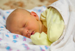 Image result for Kernicterus