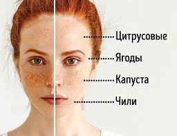 как избавиться от веснушек в домашних условиях за один день 8 Sekretov Pitaniya Ot Dermatologa Chtoby Kozha Stala Idealnoj Sredstva Dlya Kozhi Kozha Tonalnyj Krem