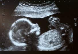 Kindsbewegungen in der schwangerschaftab wann sie das baby spüren können. 15 Ssw Schwangerschaftswoche Grosse Entwicklung 9monate De