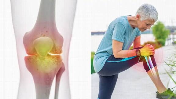 Knee Pain for No Reason: Finding Soothing Relief with the Magic of a Knee  Massager | MONKIKASHOP