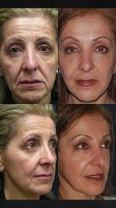 Drs. Elie & Jody Levine (@plasticsurgerydermatologynyc) · New York City, NY