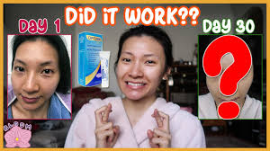 Since this drug is absorbed through the skin and may harm an unborn baby, women who are pregnant or who may become pregnant should not handle this medication. I Tried Differin For My Fungal Acne For 30 Days Did It Work Explaining Everything Tips Youtube