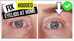 How i got rid of my hooded eyes (without surgery). How To Get Rid Of Hooded Eyelids Home Eyelid Tightening Youtube
