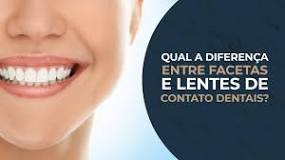 Facetas e Lente de Contato Dental: qual é a diferença?
