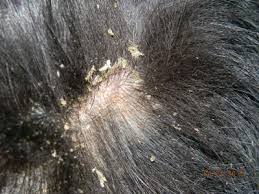 Along with hair loss around the ears, eyes, abdomen, and chest, signs your dog may have mites or fleas/ticks include inflammation, itching and redness. How To Stop Dog Hair Loss Itchy Dog Skin Dog Skin Problems Pictures Dog Flaky Skin