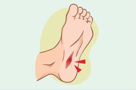 .bahawa jika seseorang yang baru sahaja mengalami kencing manis, kencing manisnya boleh sembuh dengan menurunkan berat badannya. Mitos Atau Fakta Pengidap Diabetes Berisiko Terkena Tetanus