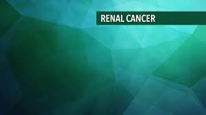 Advanced cancer means cancer that can't be cured. Treatment Of Stages I Iii Kidney Cancer Cancerconnect