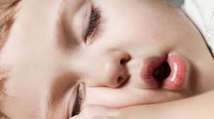 Pot manca o inghetata intreaga singur? Cea Mai FinÄƒ SelecÈ›ie Bine Cunoscute Intra Online Tratament Homeopat Polipi Copii Generalpromo Ro