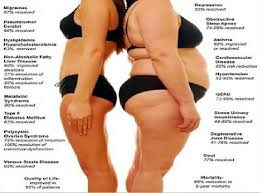 Potato Diet Lose Up To 5 Kg In 3 Days potato diet lose up to 5 kg in 3 days