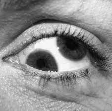 Walaupun kepercayaan karut tentang mata kiri bergerak yang membawa petanda nasib buruk atau baik boleh dijadikan bahan. Ketika Mata Sebelah Kiri Berkedut Dalam Beberapa Hari Faisal Tanjung