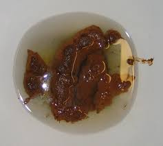 Image result for blood in stool human poop