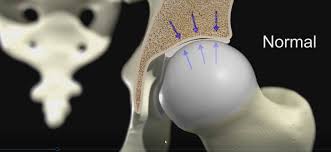 There are trabeculae in spongy bone which gives its sponge like appearance. Blendermeds Bone Cross Section Tutorial Blendernation