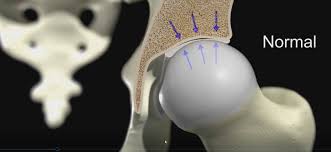 I don't find it enhances the image. Blendermeds Bone Cross Section Tutorial Blendernation