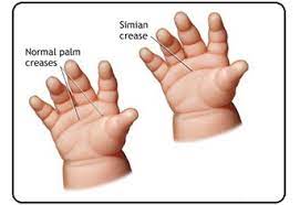 We did not find results for: Rumah Berbagi Cerita Arti Garis Tangan Simian Line