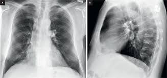 Image result for Incidental Imaging Finding