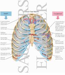 Numbered ribs, sternum, cartilage parts and clavicular articulation. Thoracic Cage Injuries