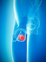 Swelling can feel like an irregular thickening on your testicle. From Boozing Too Much To Cancer Why Your Balls Might Shrink And When To Worry