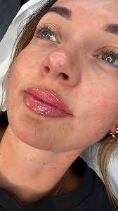 Can we please normalise actually giving our clients beautiful results and  not just fitting in with trends ?? Please 🙏