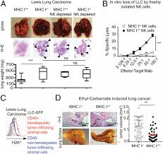 Avoiding contact with certain viruses and other pathogens also are likely to prevent some cancers. Modulation Of Nkg2d Nkp46 And Ly49c I Facilitates Natural Killer Cell Mediated Control Of Lung Cancer Pnas