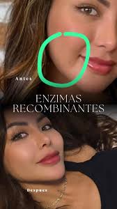 Galier 🏛️ Armonización Orofacial (@galier__) • Instagram photos and videos