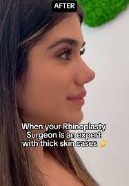 One Year Later Game Changer Results