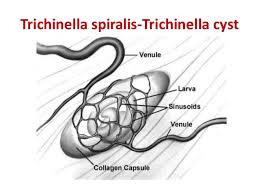 From the body is called excretion. Labeled Diagram Of Trichinella Data Wiring Diagram Schematic