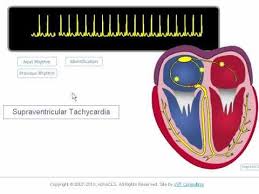 Electrocardiography is the process of producing an electrocardiogram (ecg or ekg). Pin On Ebu