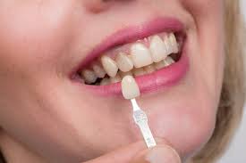 Common Dental Crown Problems And Solutions Angela Evanson Dds In Parker Co Dentist 720 409 0008 80134