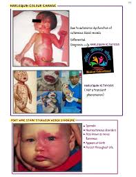 Image result for Harlequin Color Change