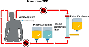 Image result for Anticoagulation