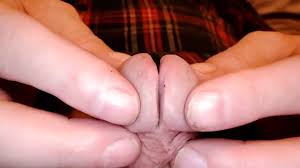 showing my new modding of my split glans