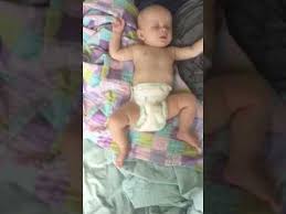 Baby Restless Leg Syndrome Youtube