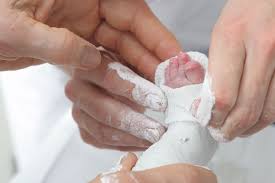Alles Rund Um Den Gips Notfallzentrum Kantonsspital Winterthur Ksw