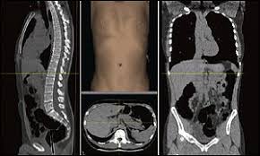 Image result for full body scan