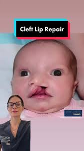 Sienna Crooked Teeth