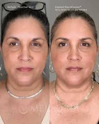 This memoriam piece was a sentimental one for me. Candy is my best friends  Mom and I consider their family a second family to me. Last year, we sadly  lost Richard, Candy's