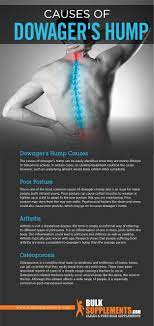 The nape of the neck is looked upon as a sensuous part of the body. Dowager S Hump Symptoms Causes Treatment Bulksupplements Com
