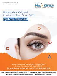 Retain Your Original Look And Feel Good With Eyebrow Transplant Eyebrowtransplant Eyesolution Eye Eyebrow Transplant Hair Implants Eyebrow Hair Transplant