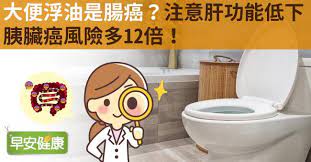 國民健康署免費成人健康檢查 國民健康署戒菸特別門診 一般外傷處理 流感疫苗及各種公自費疫苗注射 血液生化尿液糞便檢查 各種自費健康檢查 三. èƒ°è‡Ÿç™Œå‰å…† å¤§ä¾¿æµ®æ²¹è„‚è‚ªä¾¿ æ³¨æ„é¢¨éšªé«˜12å€ æ—©å®‰å¥åº·
