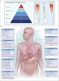 Cardiogenic Shock | New England Journal of Medicine