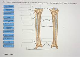 Mar 30, 2015 · the femur, or thighbone, is the longest and largest bone in the human body. Label The Bone Features Bone Markings Of The Tibia Chegg Com