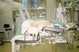 Operation Eines Lumbalen Bandscheibenvorfall