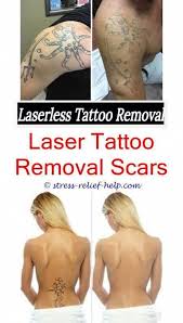 How Much Tattoo Removal Laser Best At Home Tattoo Removal Does Lemon Juice Remove Tattoos Tattoo Re Tattoo Removal Results Tattoo Removal Cost Tattoo Removal